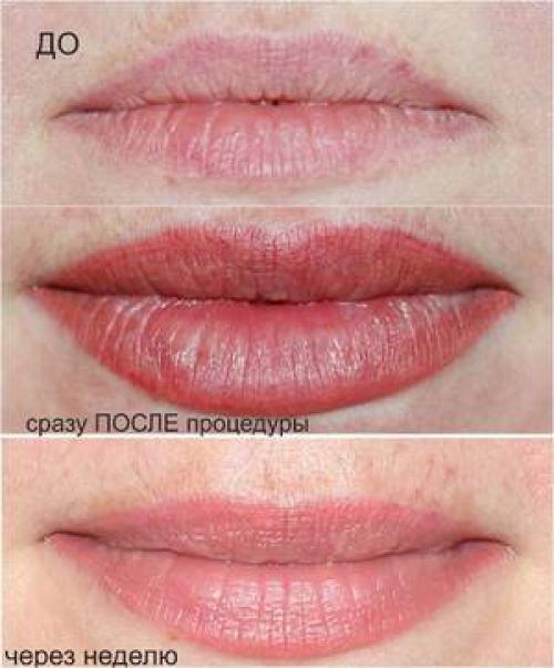 Татуаж Губ визуально увеличивает губы. Этот вопрос часто задают себе девушки, мечтающие о красивых журнальных губах и готовящие план действий. 15 Татуаж Губ визуально увеличивает губы. Этот вопрос часто задают себе девушки, мечтающие о красивых журнальных губах и готовящие план действий. 15