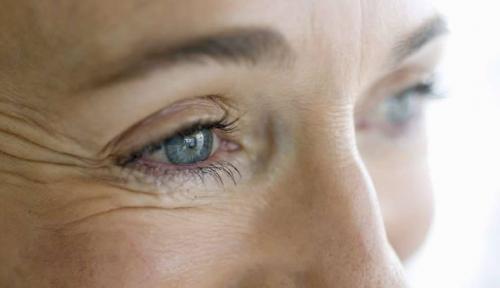 Ботокс для лица в домашних условиях. Маски с эффектом ботокса от морщин вокруг глаз в домашних условиях, отзывы