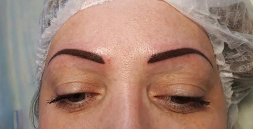 Как заживают пудровые брови. Первый день после татуажа, почему такие темные