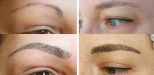 Этапы заживления пудровых бровей. Пудровые брови после коррекции