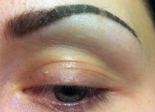 Сколько заживают брови после коррекции. Сколько заживают брови после татуажа? Сколько дней уйдет на заживление после коррекции?