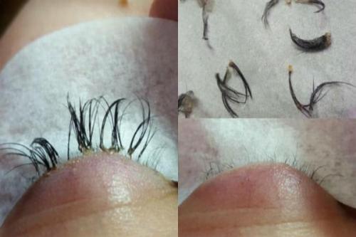 После наращивания ресниц опухло веко. Что делать, если опухли веки после наращивания ресниц и нормально ли это?