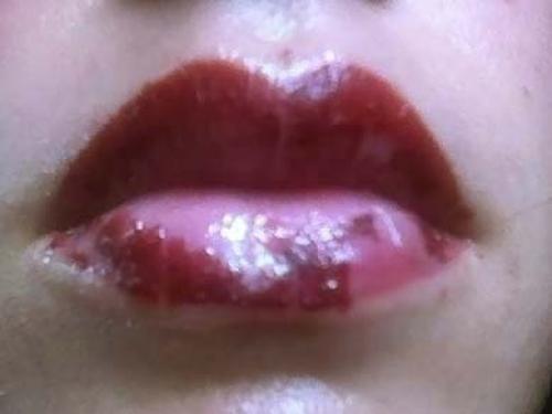 Корки на губах после татуажа. Отзыв: Татуаж губ - Мой Татуаж, процесс заживления. 08 Корки на губах после татуажа. Отзыв: Татуаж губ - Мой Татуаж, процесс заживления. 08