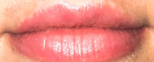 Воспаление губ после татуажа. Уход за губами после татуажа