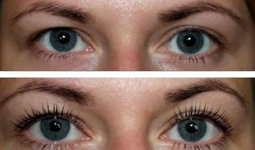 Ламинирование ресниц беременным можно или нет. Можно ли делать процедуру во время беременности 08 Ламинирование ресниц беременным можно или нет. Можно ли делать процедуру во время беременности 08