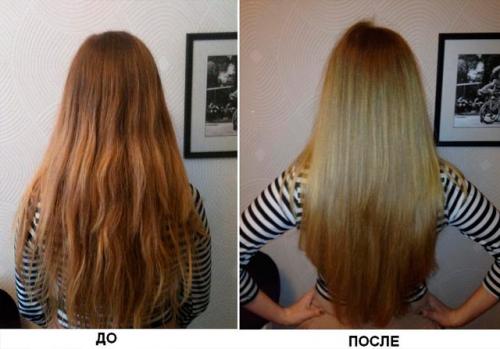 Маска эффект ботокса для волос. Что такое ботокс и технология процедуры 13 Маска эффект ботокса для волос. Что такое ботокс и технология процедуры 13