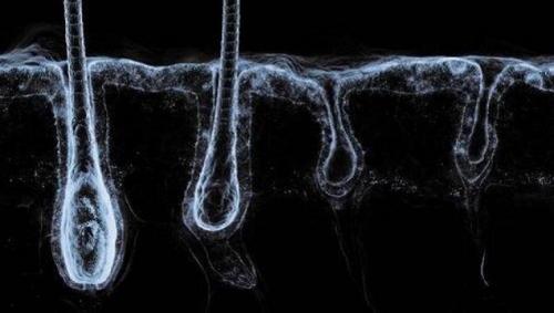 Выпадают ли ресницы после межресничного татуажа. У меня выпали все ресницы после татуажа