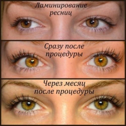Аллергия на ламинирование ресниц. Последствия ламинирования ресниц 02