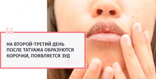 Гидрокортизон после татуажа. Уход после татуажа