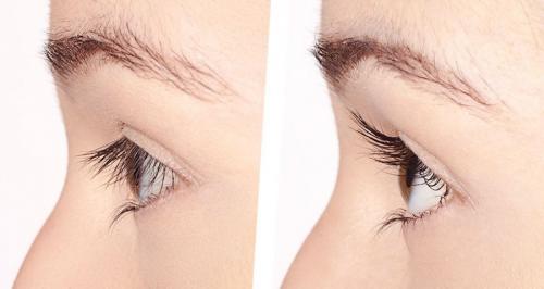 Аллергия на ламинирование ресниц. Последствия ламинирования ресниц 04