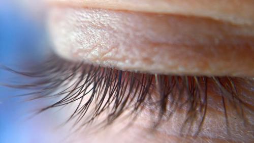 Физиология ресниц. Ресницы: функции, строение, фазы роста