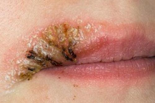 Вред татуаж губ. 01 Вред татуаж губ. 01