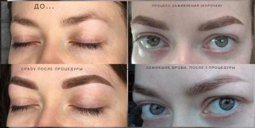 Когда нельзя делать татуаж. Причины не делать татуаж 01