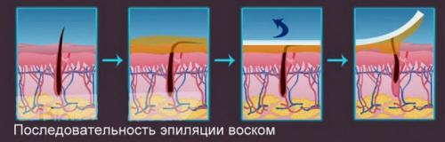 Мужская интимная эпиляция в домашних условиях. Часто используемые виды 10 Мужская интимная эпиляция в домашних условиях. Часто используемые виды 10