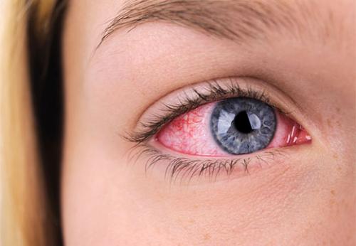 Вырастают ли вырванные ресницы. Отрастут ли ресницы заново