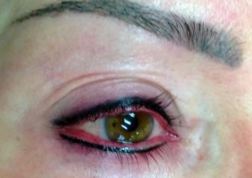 Аллергия татуаж бровей. Аллергия на татуаж бровей: как бороться с этой проблемой? 03 Аллергия татуаж бровей. Аллергия на татуаж бровей: как бороться с этой проблемой? 03