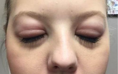 Наращивать ресницы вредно или нет. Вредно ли наращивать ресницы – мой опыт