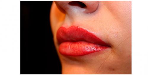 Коррекция после татуажа губ. Заживление губ после коррекции 23 Коррекция после татуажа губ. Заживление губ после коррекции 23