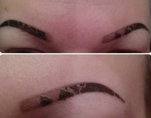 Сколько сходят корочки после микроблейдинга. Достоинства и недостатки микроблейдинга бровей 01 Сколько сходят корочки после микроблейдинга. Достоинства и недостатки микроблейдинга бровей 01