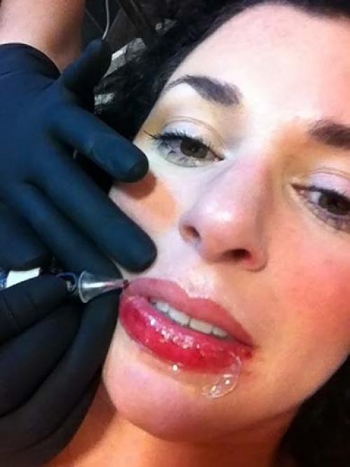 Коррекция после татуажа губ. Заживление губ после коррекции 01 Коррекция после татуажа губ. Заживление губ после коррекции 01