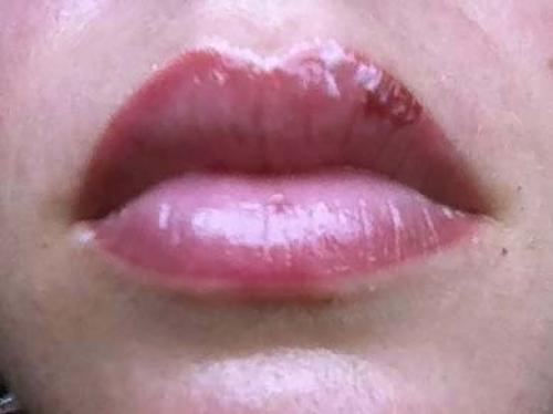 Отек губ после перманентного. Герпес на губах после перманентного макияжа губ. Татуаж губ после заживления. Герпес после перманентного макияжа губ.