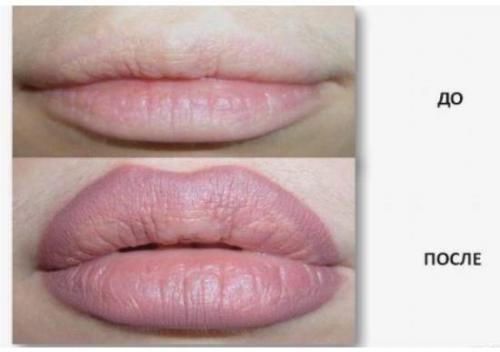 Микроблейдинг губ больно. 