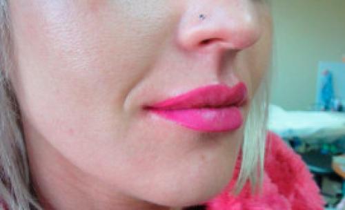 Коррекция татуажа губ форум. Повторная коррекция татуажа губ: зачем нужна и как проходит?