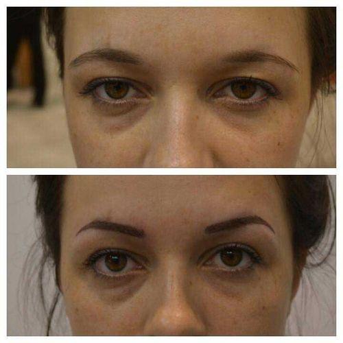 Ремувер для бровей, что такое. Удаление татуажа бровей ремувером: что необходимо знать о процедуре