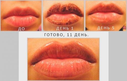 Сколько по времени заживает татуаж губ. Сколько длится период восстановления: через сколько заживает татуаж губ? 03 Сколько по времени заживает татуаж губ. Сколько длится период восстановления: через сколько заживает татуаж губ? 03