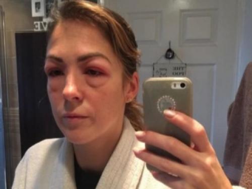 Каким клеем приклеить накладные ресницы. Выбор ресниц и подготовка инструментов 10 Каким клеем приклеить накладные ресницы. Выбор ресниц и подготовка инструментов 10