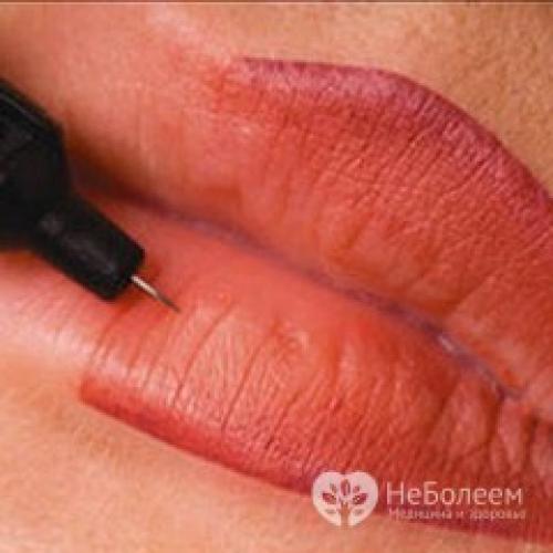 Татуаж губ противопоказания. Перманентный макияж губ