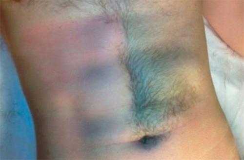 Мужской шугаринг яичек. Шугаринг яиц у мужчин