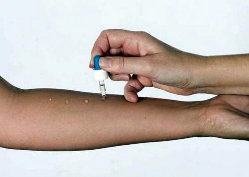 После удаления татуажа бровей лазером. Возможные осложнения после удаления татуажа бровей лазером 04 После удаления татуажа бровей лазером. Возможные осложнения после удаления татуажа бровей лазером 04