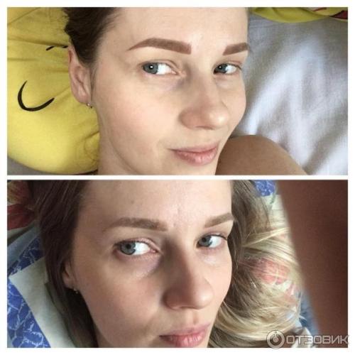 Можно ли делать Татуаж кормящим. Татуаж, аллергия и опасность инфицирования 03 Можно ли делать Татуаж кормящим. Татуаж, аллергия и опасность инфицирования 03