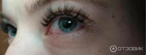 В глаза попал клей для ресниц. Если в глаз попал суперклей 06 В глаза попал клей для ресниц. Если в глаз попал суперклей 06