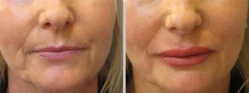 Стоит делать Татуаж губ. Напыление губ. Перманентный макияж губ, который я бы сделала 14