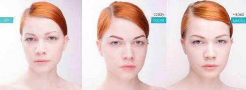 Аппаратная растушевка бровей. Теневая растушевка бровей — все «за» и «против»
