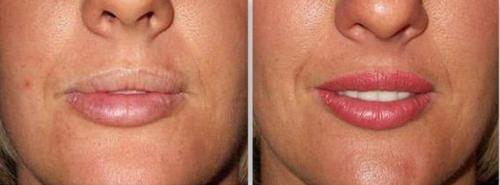 Стоит делать Татуаж губ. Напыление губ. Перманентный макияж губ, который я бы сделала 13