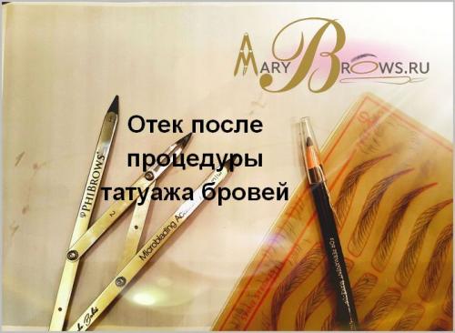 Сильный отек после татуажа бровей. Отек после процедуры татуажа бровей
