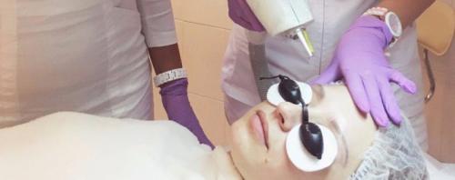 Снятие татуажа бровей лазером. Сколько сеансов потребуется? 05 Снятие татуажа бровей лазером. Сколько сеансов потребуется? 05