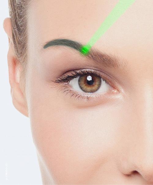 Снятие татуажа бровей лазером. Сколько сеансов потребуется? 03 Снятие татуажа бровей лазером. Сколько сеансов потребуется? 03