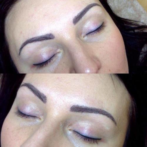 Как убрать татуаж век. Почему микропигментирование превратилось в головную боль?