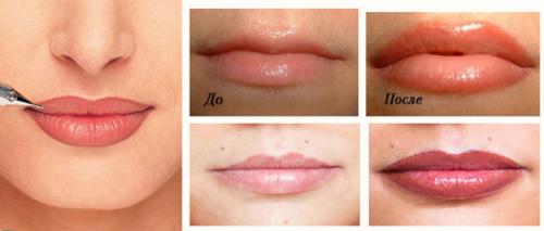 Поэтапно татуаж Губ. Эффект от перманентного макияжа губ: фото до и после