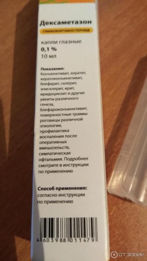 При наращивании ресниц клей попал в глаз. Что делать, если клей попал в глаз при наращивании 01 При наращивании ресниц клей попал в глаз. Что делать, если клей попал в глаз при наращивании 01