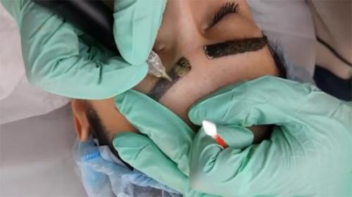 Как вывести татуаж век в домашних условиях. Как удалить татуаж в домашних условиях и в салоне