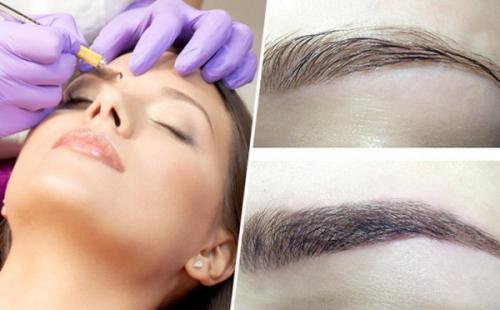 Микроблейдинг бровей заживление по дням. Процесс заживления бровей после микроблейдинга