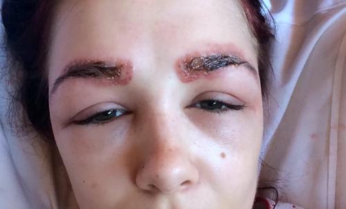 Можно ли в солярий После татуажа бровей. Как защитить перманентный макияж на открытом солнце 08 Можно ли в солярий После татуажа бровей. Как защитить перманентный макияж на открытом солнце 08