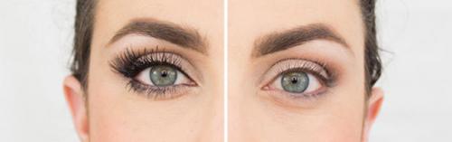 Нарощенные ресницы выпадают на следующий день. Основные причины выпадения ресниц