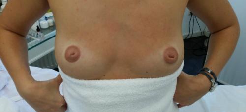 Татуаж на сосках. Что такое татуаж ареола 01