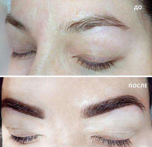 Хлоргексидин после татуажа бровей. Первый день заживления пудрового татуажа – отечность